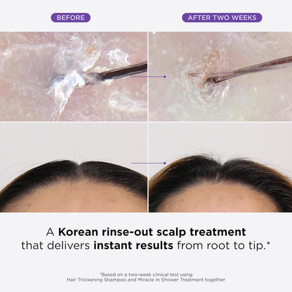 Dr. Groot Miracle in Shower Treatment